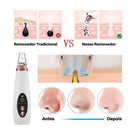 Removedor De Cravos Espinhas Cleaning Sugador Poros Acne Sucção Usb Recarregável