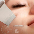 Aparelho de Peeling Esfoliante Ultrassônico Limpeza Facial Profunda Remoção de Cravos Antirrugas Sonic Skin