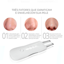 Aparelho de Peeling Esfoliante Ultrassônico Limpeza Facial Profunda Remoção de Cravos Antirrugas Sonic Skin